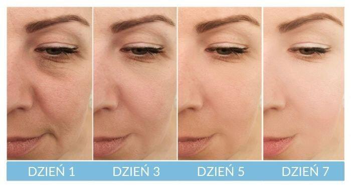 SQT odmładza, naprawia, rewitalizuje, nawilża